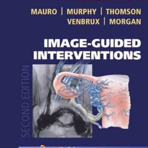 Image-Guided Interventions: Expert Radiology Series (Expert Consult – Online and Print), 2e