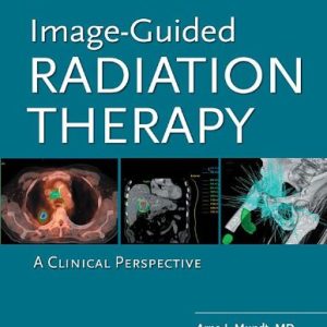 Image-Guided Radiation Therapy: A Clinical Perspective (Original PDF from Publisher)