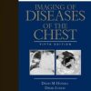 Imaging of Diseases of the Chest: Expert Consult – Online and Print, 5th (Original PDF from Publisher)