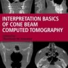Interpretation Basics of Cone Beam Computed Tomography