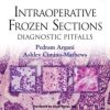 Intraoperative Frozen Sections: Diagnostic Pitfalls (Consultant Pathology) (Original PDF from Publisher)