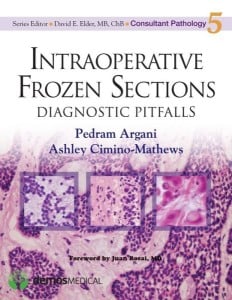 Intraoperative Frozen Sections: Diagnostic Pitfalls (Consultant Pathology) (Original PDF from Publisher)