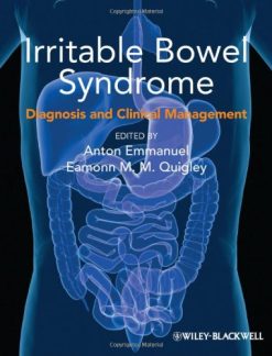 Irritable Bowel Syndrome: Diagnosis and Clinical Management (Original PDF from Publisher)