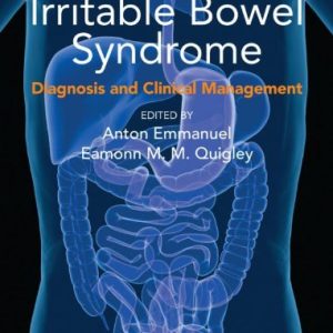Irritable Bowel Syndrome: Diagnosis and Clinical Management (Original PDF from Publisher)