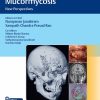 Invasive Skull Base Mucormycosis New Perspectives (Original PDF from Publisher+Videos)