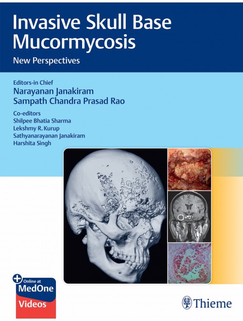 Invasive Skull Base Mucormycosis New Perspectives (Original PDF from Publisher+Videos)