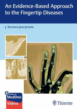An Evidence-Based Approach To The Fingertip Diseases (Original PDF from Publisher)