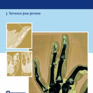 An Evidence-Based Approach To The Fingertip Diseases (Original PDF from Publisher)