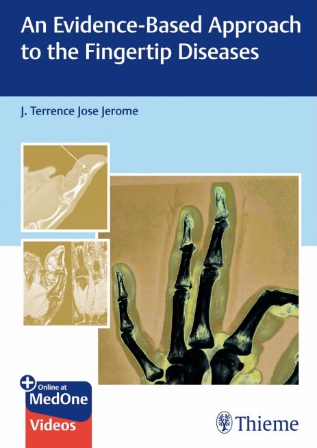 An Evidence-Based Approach To The Fingertip Diseases (Original PDF from Publisher)