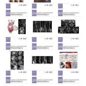 Journal of Neurosurgery Pediatrics 2023 Full Archives (True PDF)