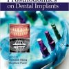 Journal of Prosthodontics on Dental Implants