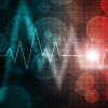 Mayo Clinic Practical ECG Pearls – ECG Rhythm Update 2020 (Videos)