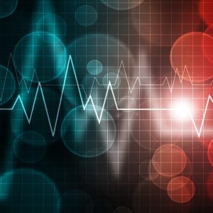 Mayo Clinic Practical ECG Pearls – ECG Rhythm Update 2020 (Videos)