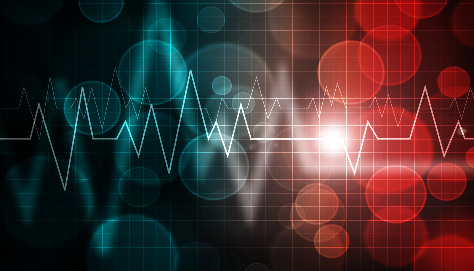 Mayo Clinic Practical ECG Pearls – ECG Rhythm Update 2020 (Videos)