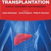 Liver Transplantation: Clinical Assessment and Management (Original PDF from Publisher)