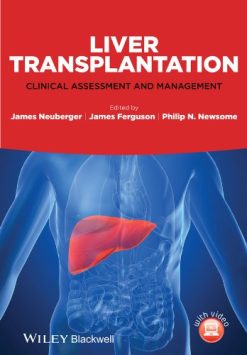 Liver Transplantation: Clinical Assessment and Management (Original PDF from Publisher)