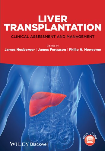 Liver Transplantation: Clinical Assessment and Management (Original PDF from Publisher)