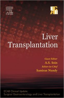 Liver Transplantation – ECAB