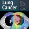Lung Cancer, 4th Edition (Original PDF from Publisher)