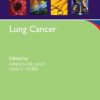Lung Cancer (Oxford American Oncology Library)