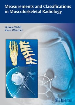 Measurements and Classifications in Musculoskeletal Radiology (Original PDF from Publisher)