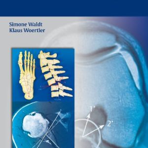 Measurements and Classifications in Musculoskeletal Radiology (Original PDF from Publisher)