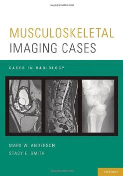 Musculoskeletal Imaging Cases (Cases in Radiology)