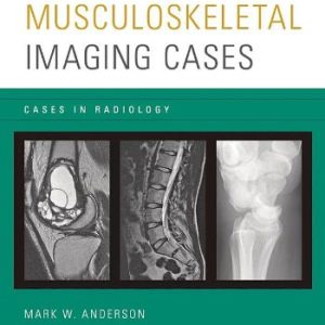 Musculoskeletal Imaging Cases (Cases in Radiology)