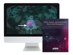 ARRS Pitfalls, Variants, and Pseudolesions: How to Avoid Misdiagnosis 2019 (Videos)