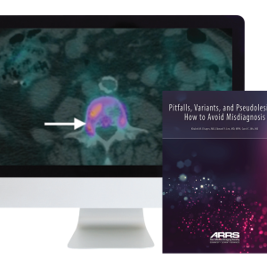 ARRS Pitfalls, Variants, and Pseudolesions: How to Avoid Misdiagnosis 2019 (Videos)