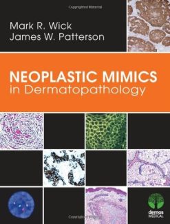 Neoplastic Mimics in Dermatopathology (Pathology of Neoplastic Mimics) (Original PDF from Publisher)