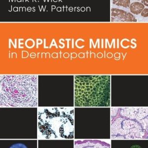 Neoplastic Mimics in Dermatopathology (Pathology of Neoplastic Mimics) (Original PDF from Publisher)
