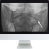 Neuroradiology Review for the Practicing Radiologist 2018 (ARRS VIDEOS) (Videos)