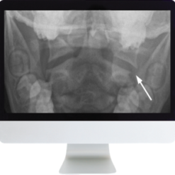 Neuroradiology Review for the Practicing Radiologist 2018 (ARRS VIDEOS) (Videos)