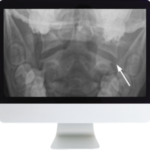 Neuroradiology Review for the Practicing Radiologist 2018 (ARRS VIDEOS) (Videos)