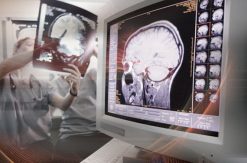 Penn Radiology Comprehensive Neuroradiology: Imaging Ideals 2022 (Videos)