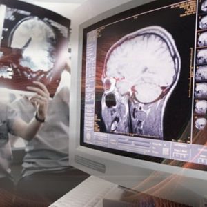 Penn Radiology Comprehensive Neuroradiology: Imaging Ideals 2022 (Videos)