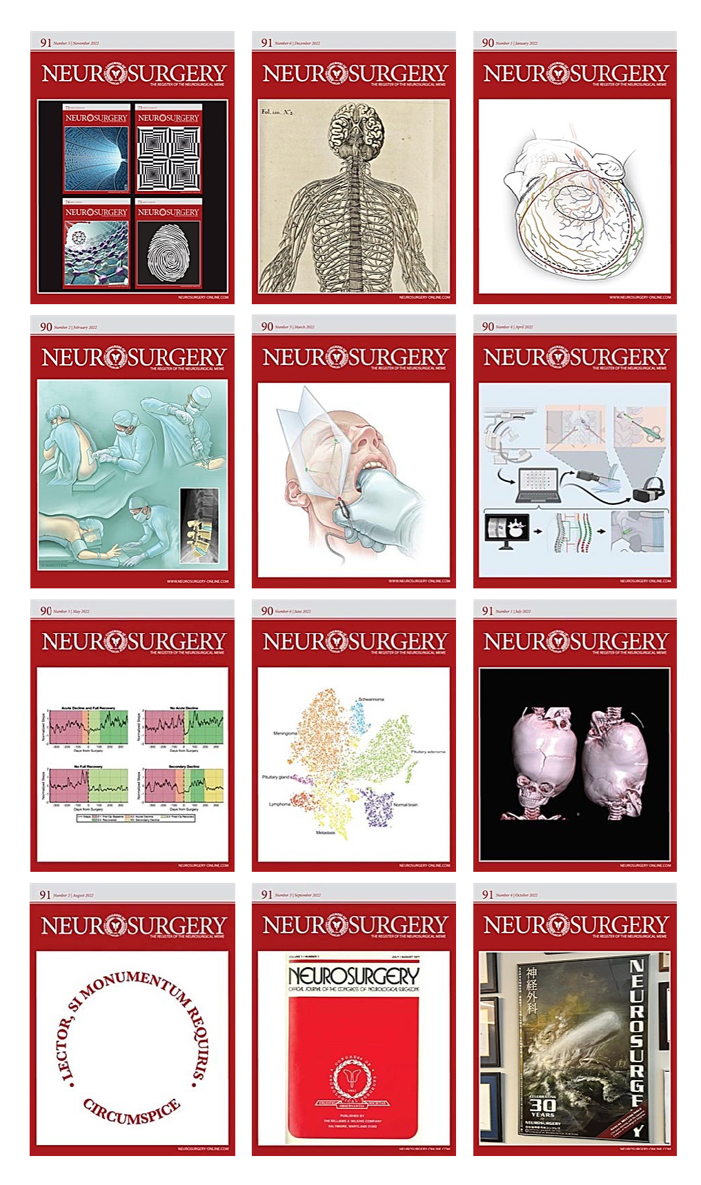 Neurosurgery 2022 Full Archives (True PDF)