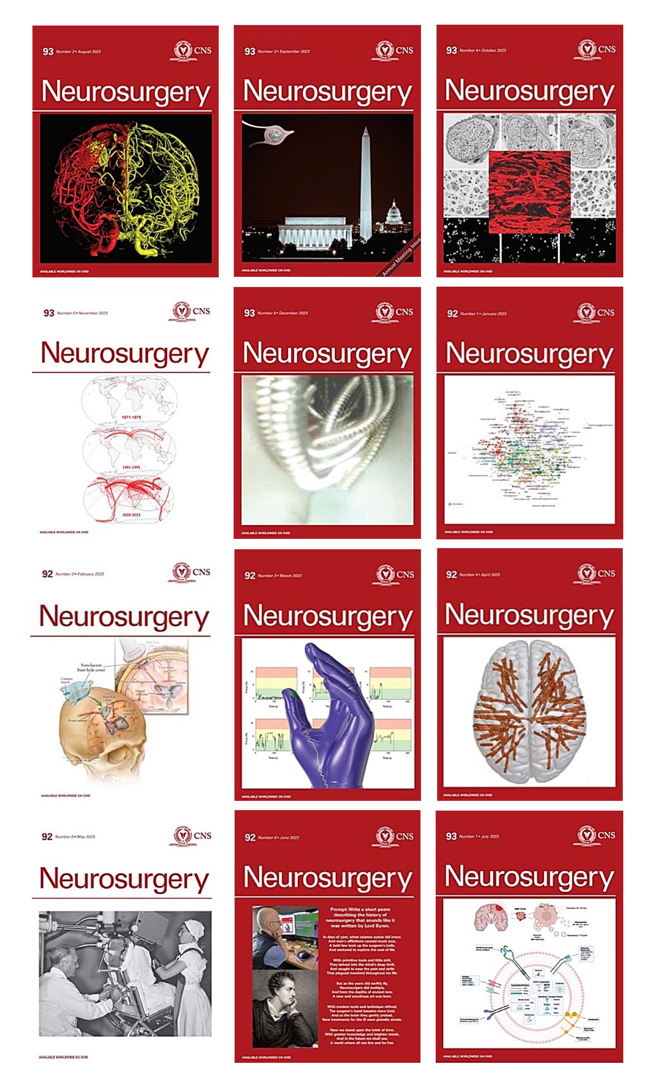 Neurosurgery 2023 Full Archives (True PDF)