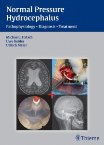 Normal Pressure Hydrocephalus: Pathophysiology – Diagnosis – Treatment (ORIGINAL PDF FROM THE PUBLISHER)