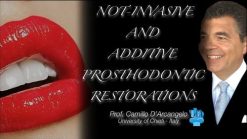 Non-Invasive and Additive Prosthodontics Restorations (Videos)