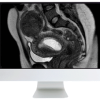 ARRS Abdominal MRI: Practical Applications and Advanced Imaging Techniques 2021 (Videos)