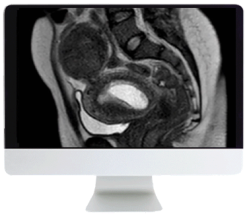 ARRS Abdominal MRI: Practical Applications and Advanced Imaging Techniques 2021 (Videos)