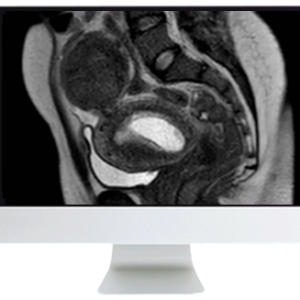 ARRS Abdominal MRI: Practical Applications and Advanced Imaging Techniques 2021 (Videos)
