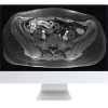 ARRS A Guide to Bowel Imaging 2019 (Videos)