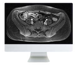 ARRS A Guide to Bowel Imaging 2019 (Videos)