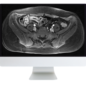 ARRS A Guide to Bowel Imaging 2019 (Videos)