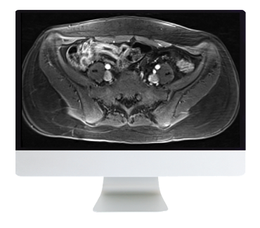 ARRS A Guide to Bowel Imaging 2019 (Videos)