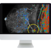 Breast Imaging Pearls and Pitfalls: Traditional and Novel Imaging Approaches 2020 (Videos)