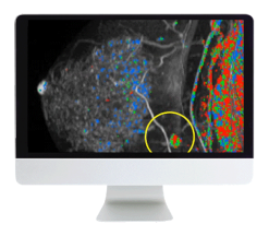 Breast Imaging Pearls and Pitfalls: Traditional and Novel Imaging Approaches 2020 (Videos)